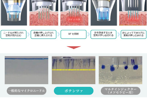 ドラッグデリバリーシステム 薬剤浸透イメージ